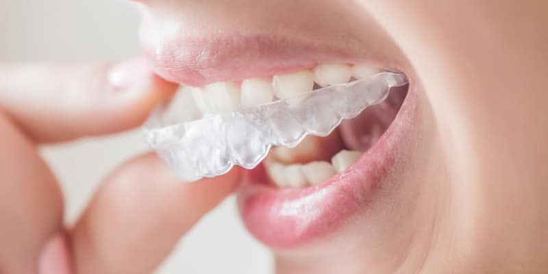 zestaw do wybielania zębów